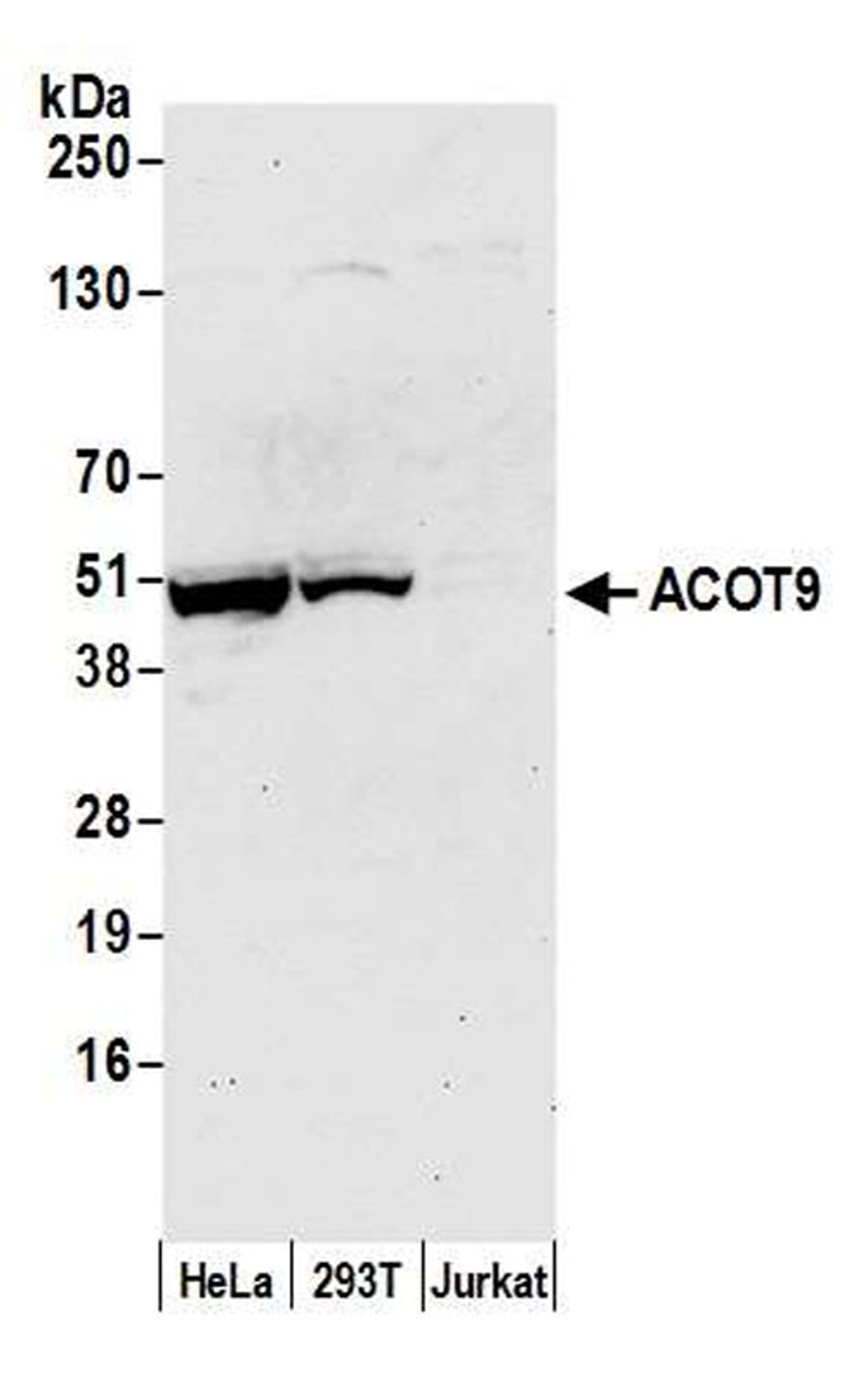 Detection of human ACOT9 by WB.