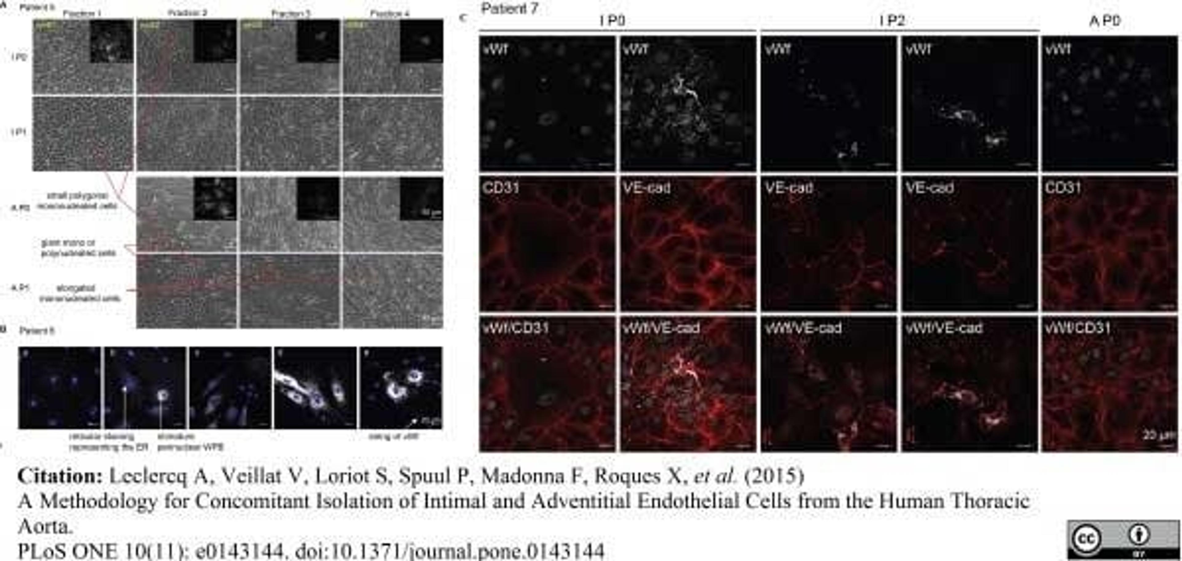 Sheep anti Human von Willebrand Factor antibody used for the evaluation of von Willebrand factor