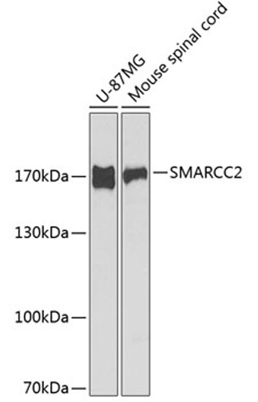 Western blot - SMARCC2 antibody (A1967)