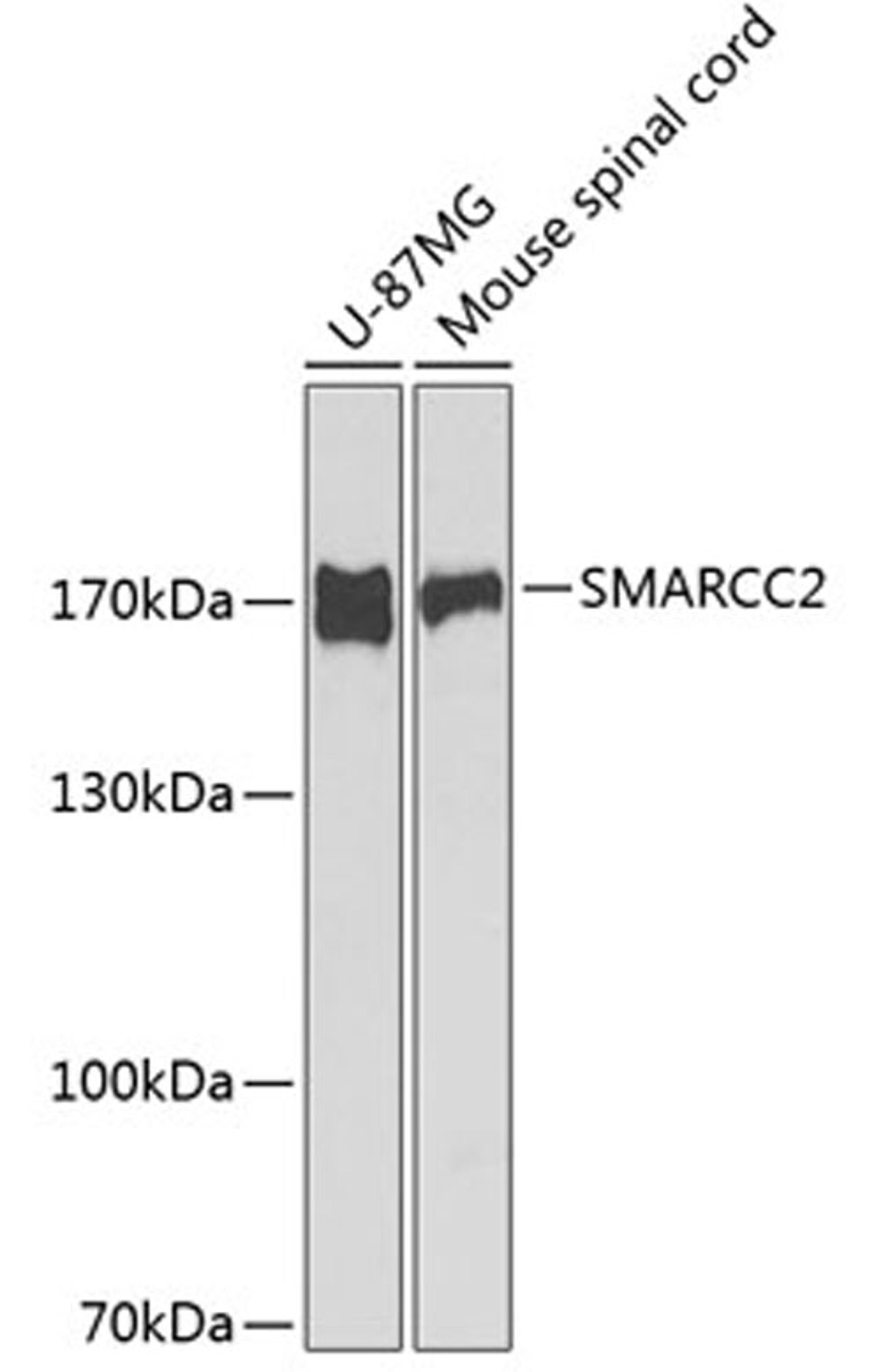 Western blot - SMARCC2 antibody (A1967)