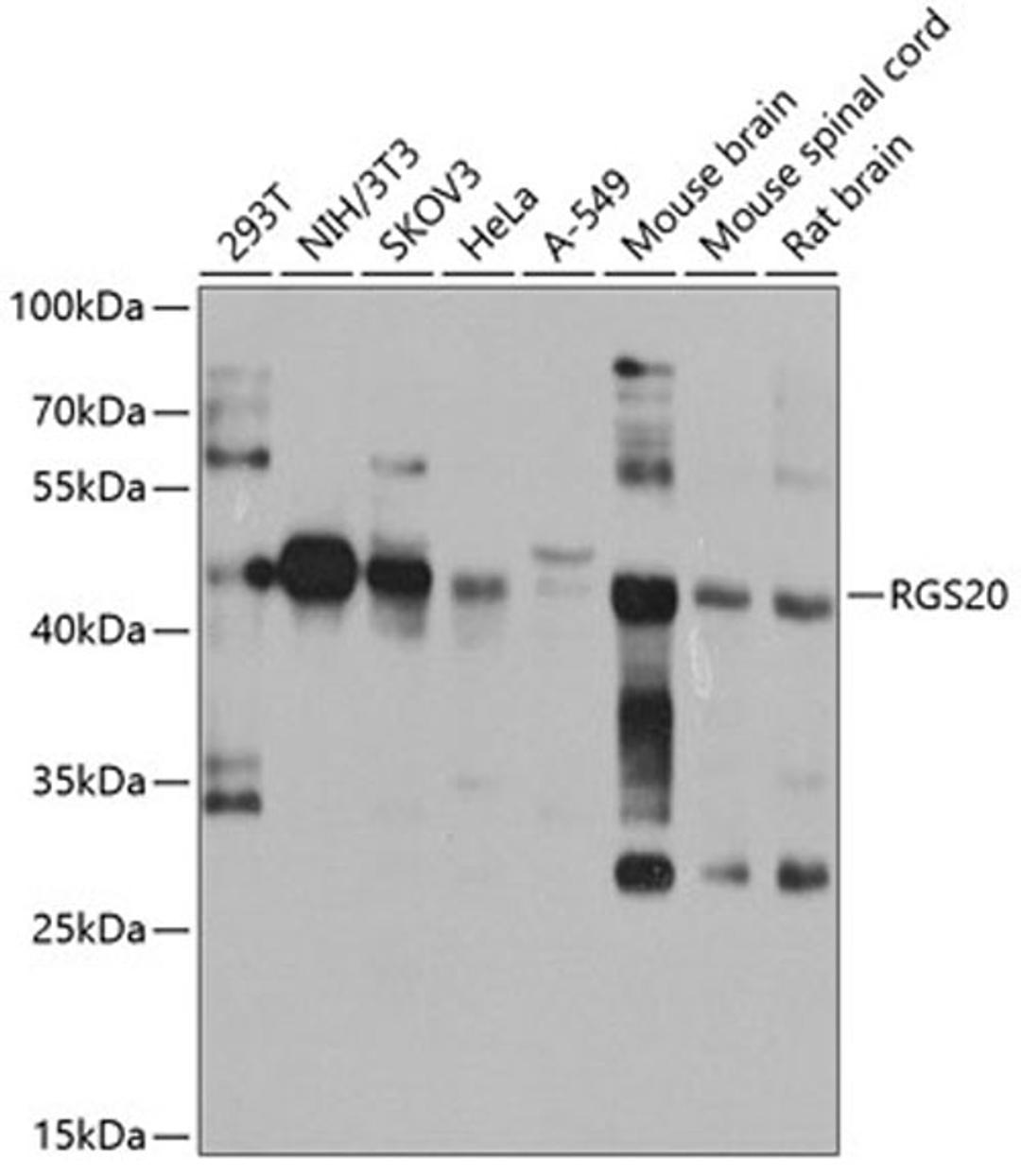 Western blot - RGS20 antibody (A8167)