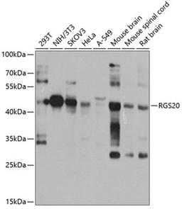 Western blot - RGS20 antibody (A8167)