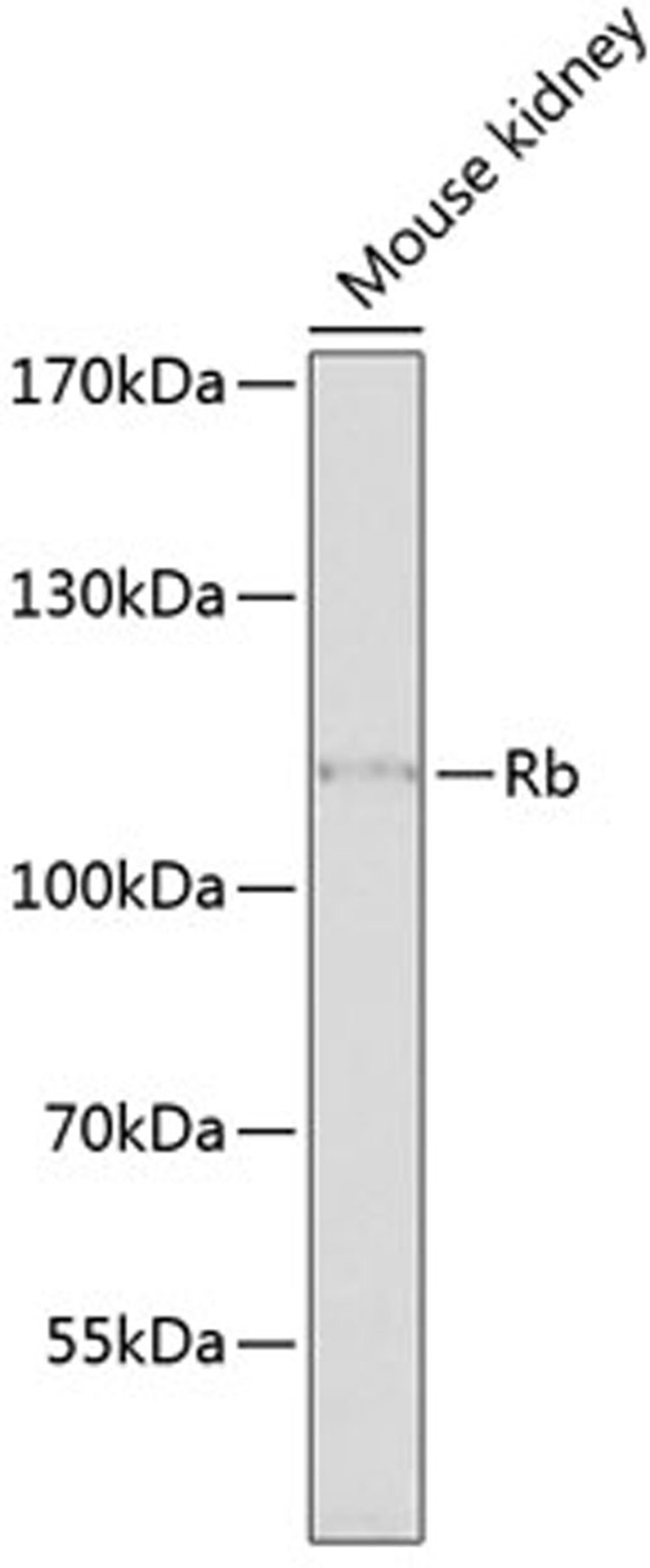 Western blot - Rb antibody (A2116)