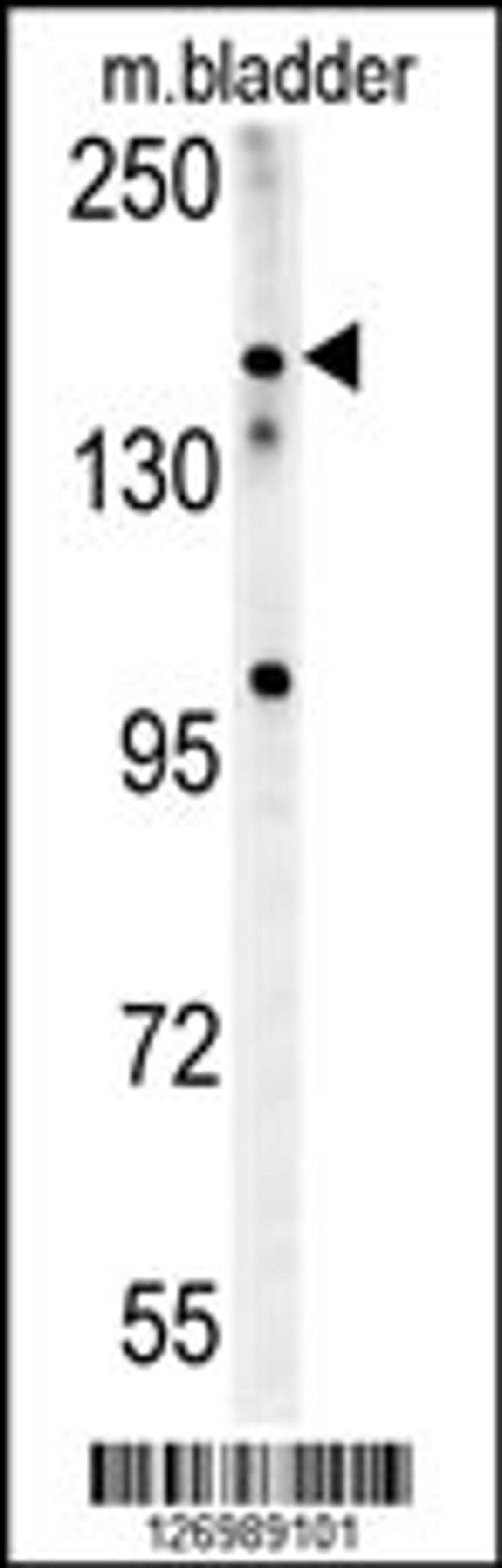 Western blot analysis in mouse bladder tissue lysates (15ug/lane).This demonstrates the detected CASZ1 protein (arrow).