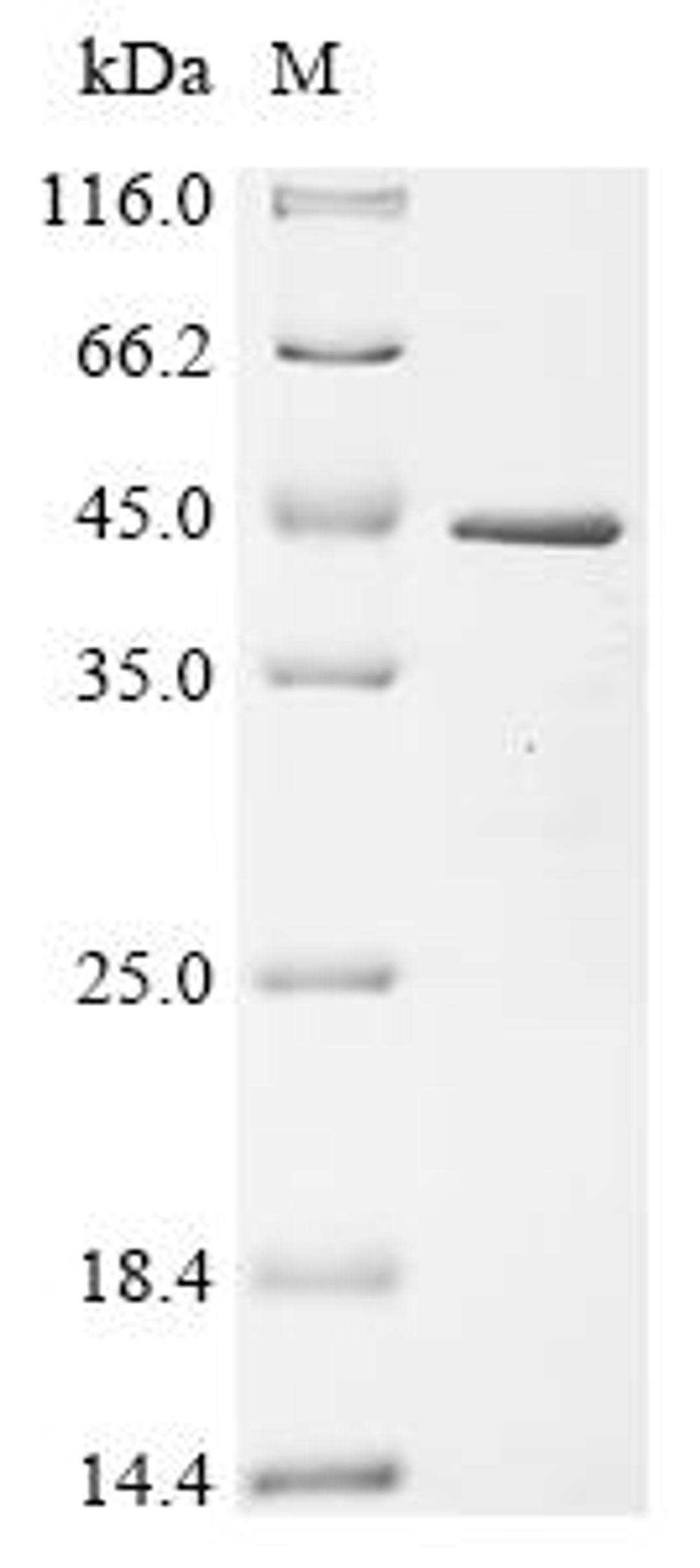 (Tris-Glycine gel) Discontinuous SDS-PAGE (reduced) with 5% enrichment gel and 15% separation gel.