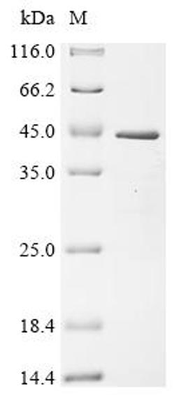 (Tris-Glycine gel) Discontinuous SDS-PAGE (reduced) with 5% enrichment gel and 15% separation gel.