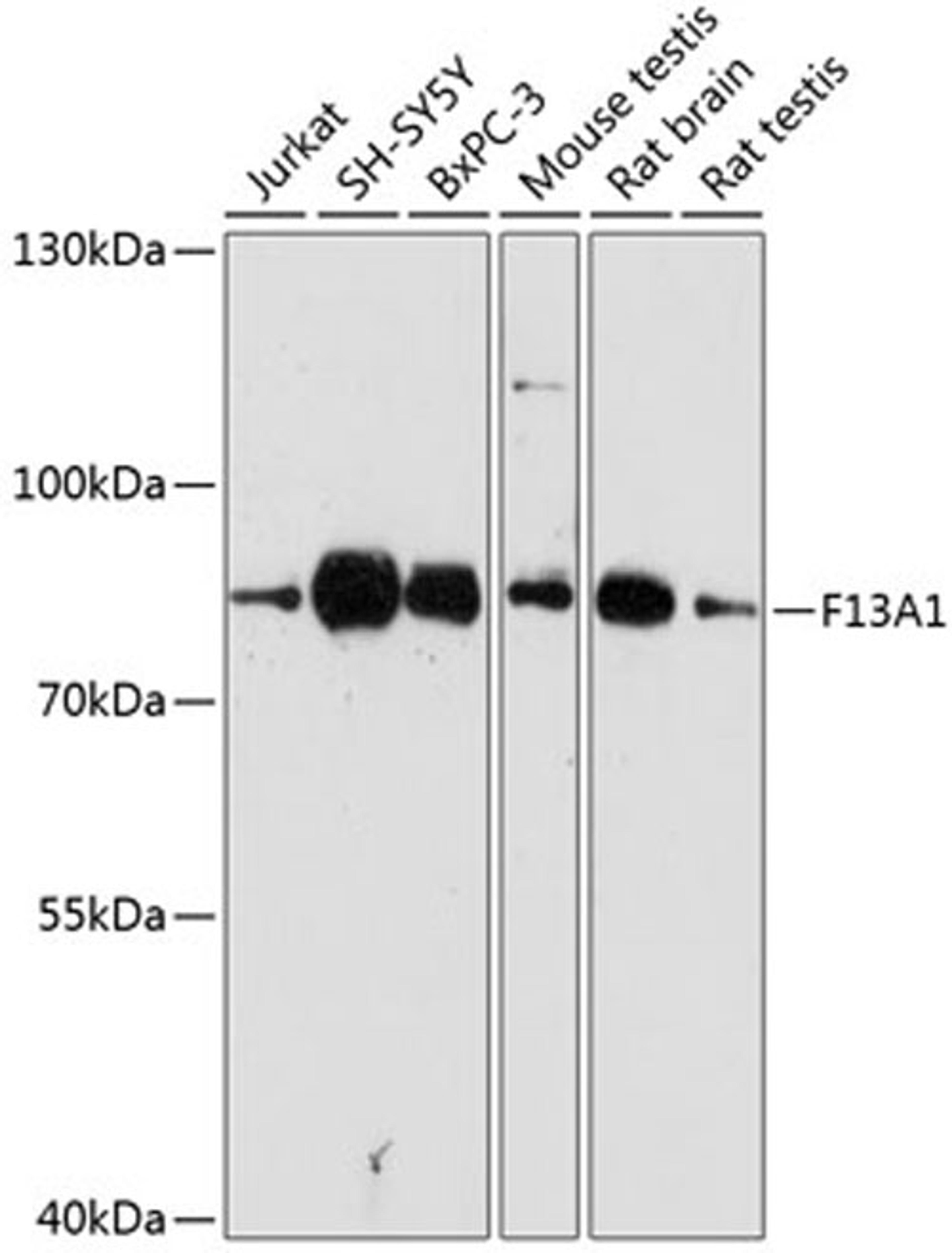 Western blot - F13A1 antibody (A1461)