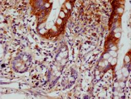 IHC image of CSB-RA213020A0HU diluted at 1:100 and staining in paraffin-embedded human small intestine tissue performed on a Leica BondTM system. After dewaxing and hydration, antigen retrieval was mediated by high pressure in a citrate buffer (pH 6.0). Section was blocked with 10% normal goat serum 30min at RT. Then primary antibody (1% BSA) was incubated at 4°C overnight. The primary is detected by a Goat anti-rabbit polymer IgG labeled by HRP and visualized using 0.05% DAB.