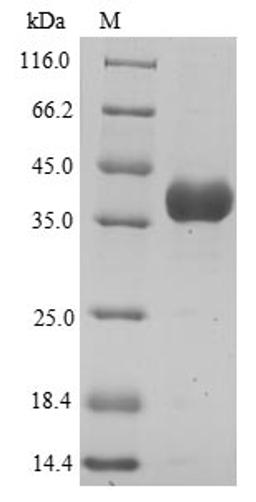 (Tris-Glycine gel) Discontinuous SDS-PAGE (reduced) with 5% enrichment gel and 15% separation gel.