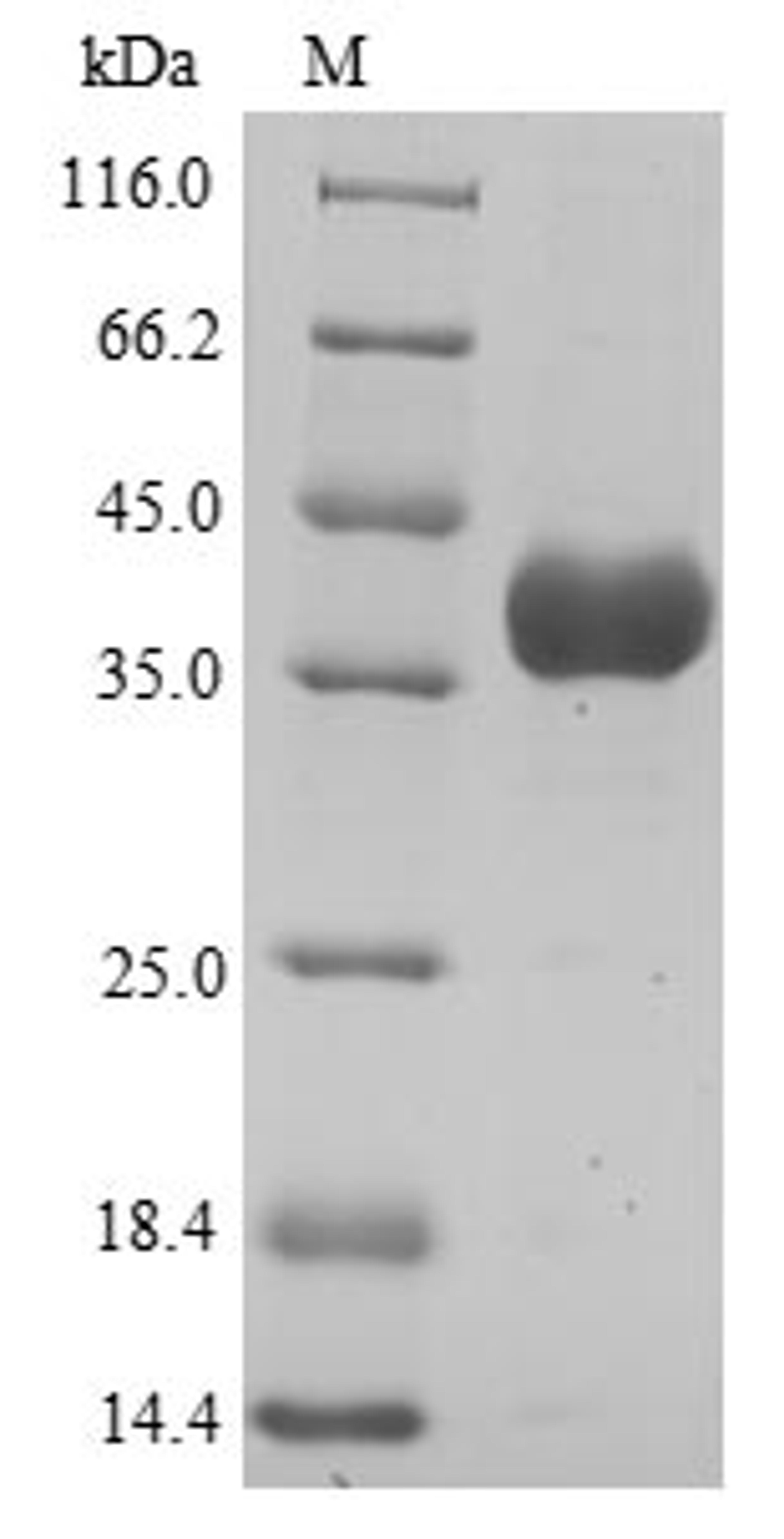 (Tris-Glycine gel) Discontinuous SDS-PAGE (reduced) with 5% enrichment gel and 15% separation gel.