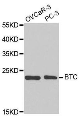 Western blot analysis of extracts of various cell lines using BTC antibody