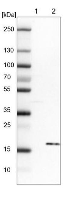 Western Blot: S100A16 Antibody [NBP1-92361] - Lane 1: NIH-3T3 cell lysate (Mouse embryonic fibroblast cells)<br/>Lane 2: NBT-II cell lysate (Rat Wistar bladder tumour cells)