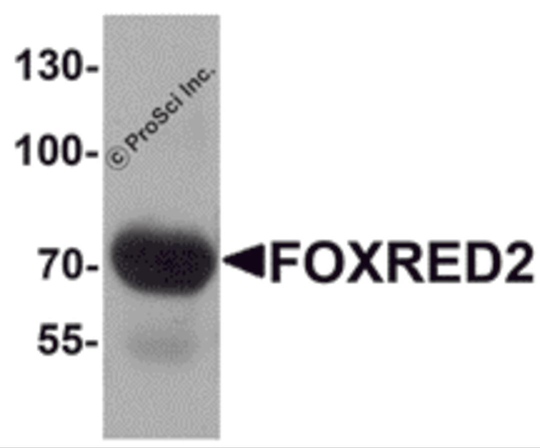 Western blot analysis of FOXRED2 in human lung tissue lysate with FOXRED2 antibody at 1 μg/mL.