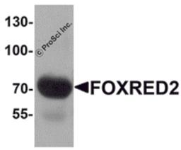 Western blot analysis of FOXRED2 in human lung tissue lysate with FOXRED2 antibody at 1 μg/mL.