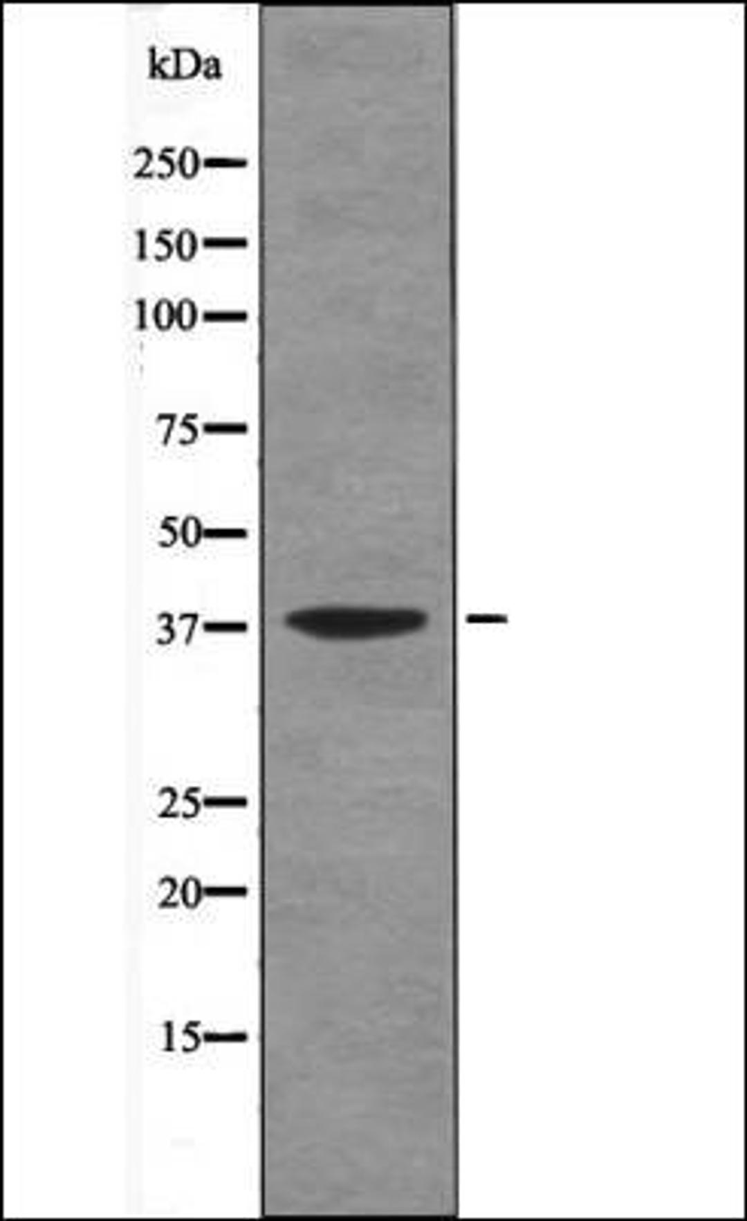 Western blot analysis of UV treated Jurkat whole cell lysates using AMPKB1 -Phospho-Ser108- antibody