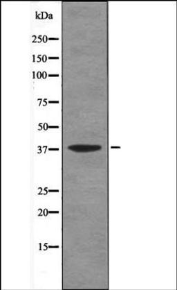 Western blot analysis of UV treated Jurkat whole cell lysates using AMPKB1 -Phospho-Ser108- antibody