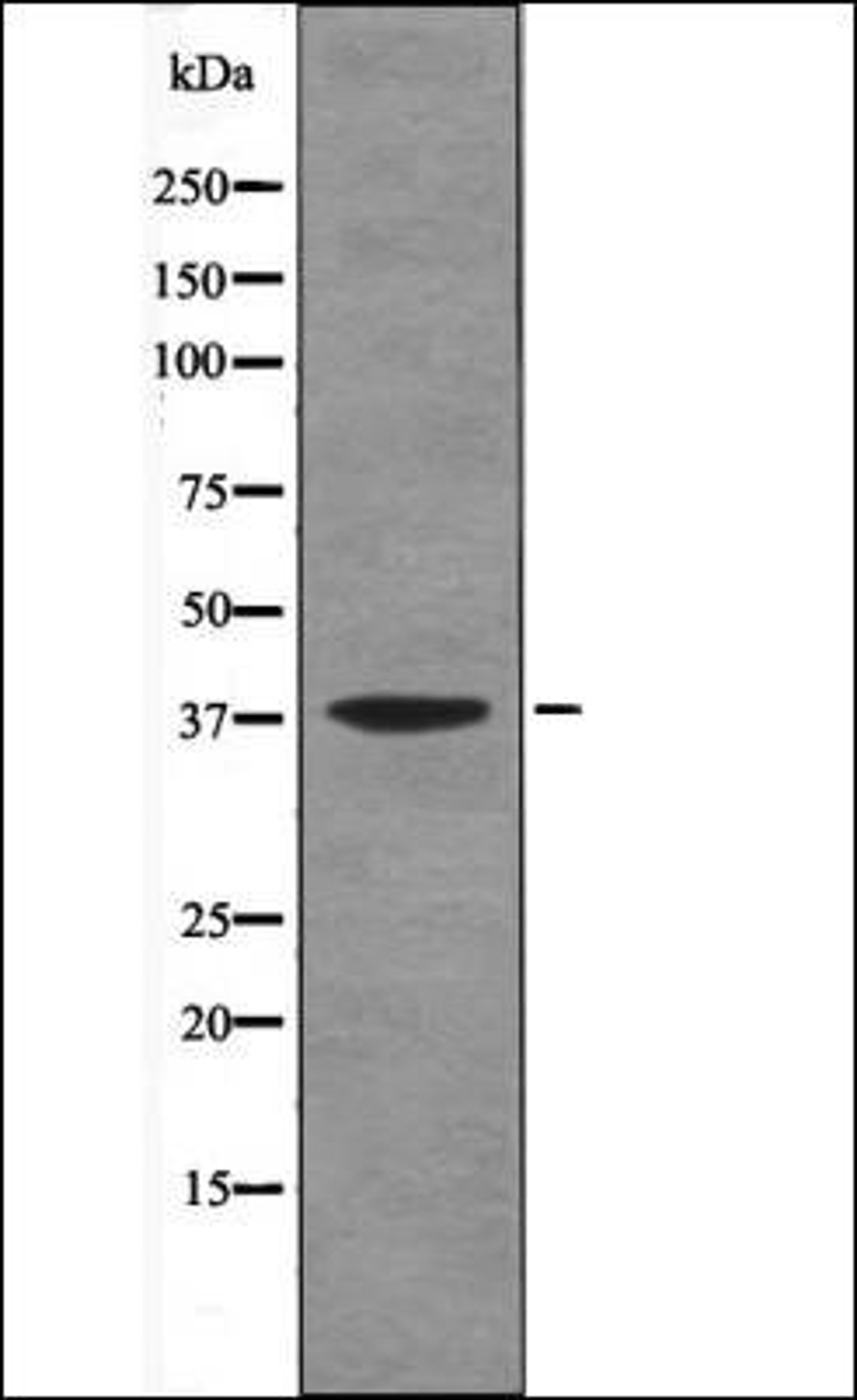 Western blot analysis of UV treated Jurkat whole cell lysates using AMPKB1 -Phospho-Ser108- antibody