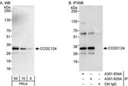 Detection of human CCDC124 by western blot and immunoprecipitation.