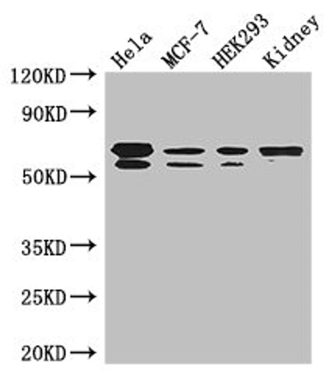 Western Blot. Positive WB detected in: Hela whole cell lysate, MCF-7 whole cell lysate, HEK293 whole cell lysate, Mouse kidney tissue. All lanes: RBPJ antibody at 3.5ug/ml. Secondary. Goat polyclonal to rabbit IgG at 1/50000 dilution. Predicted band size: 56, 48, 46, 55, 52 kDa. Observed band size: 56, 55 kDa. 