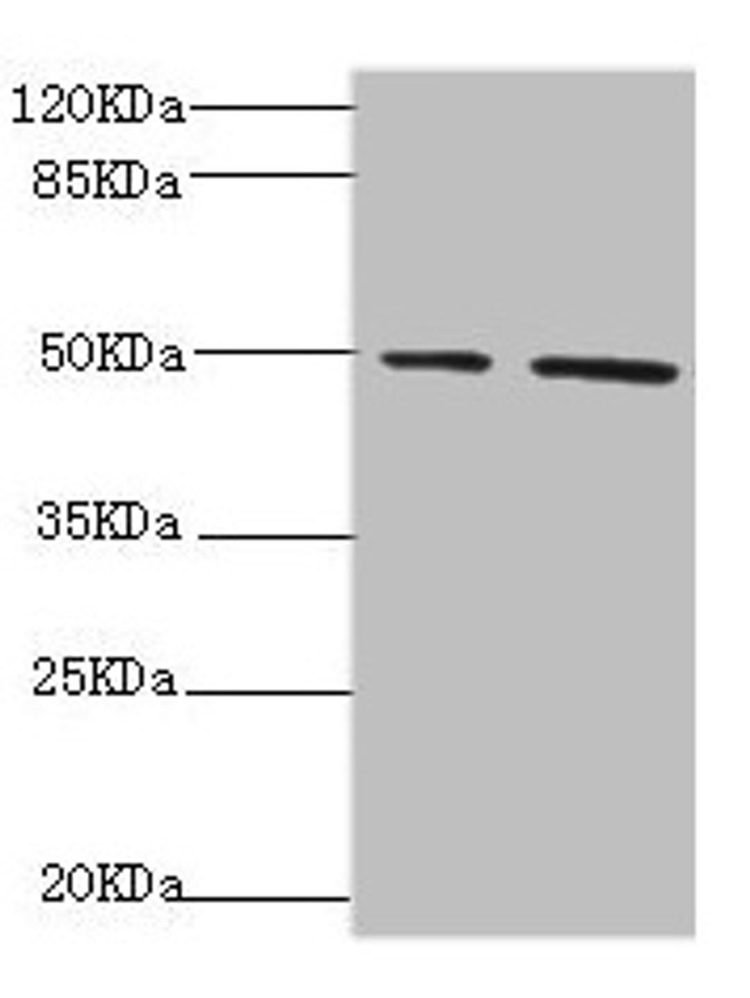 Western blot. All lanes: NFS1 antibody at 6.21µg/ml. Lane 1: HepG2 whole cell lysate. Lane 2: Hela whole cell lysate. Secondary. Goat polyclonal to rabbit IgG at 1/10000 dilution. Predicted band size: 51, 45 kDa. Observed band size: 51 kDa