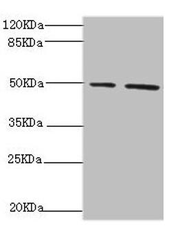 Western blot. All lanes: NFS1 antibody at 6.21µg/ml. Lane 1: HepG2 whole cell lysate. Lane 2: Hela whole cell lysate. Secondary. Goat polyclonal to rabbit IgG at 1/10000 dilution. Predicted band size: 51, 45 kDa. Observed band size: 51 kDa