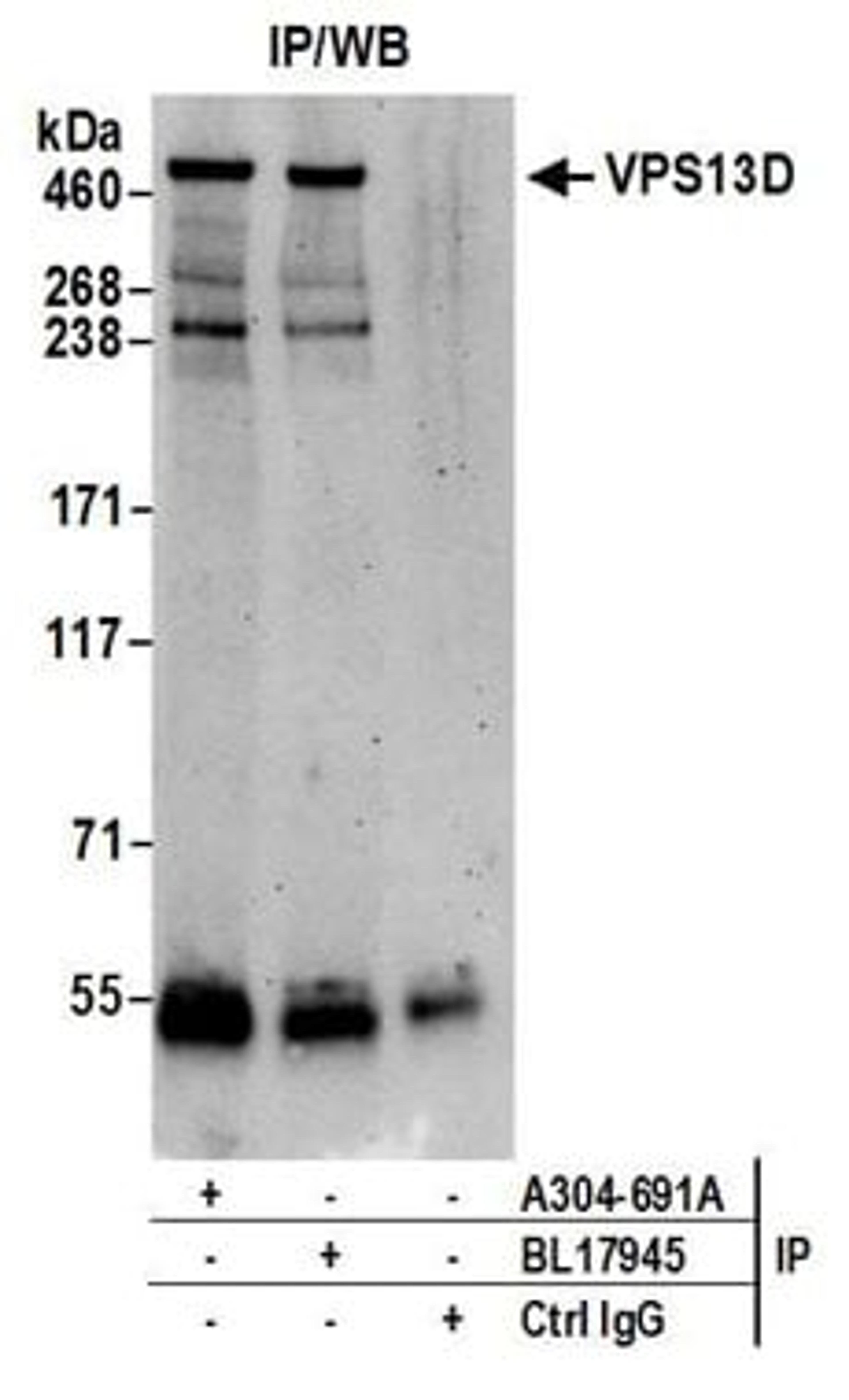 Detection of human VPS13D by western blot of immunoprecipitates.