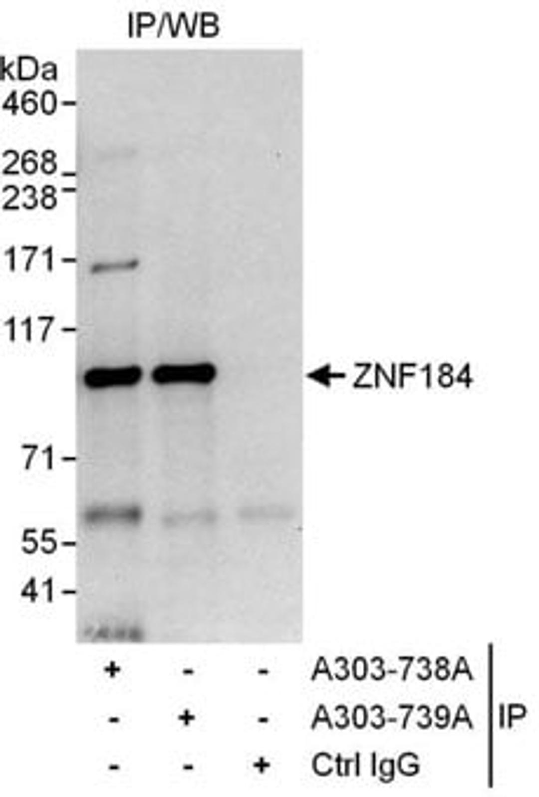 Detection of human ZNF184 by western blot of immunoprecipitates.