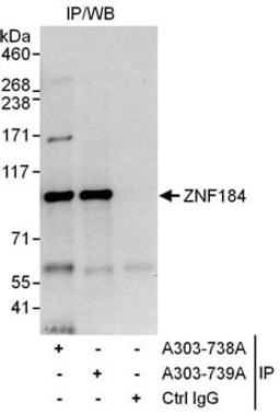 Detection of human ZNF184 by western blot of immunoprecipitates.