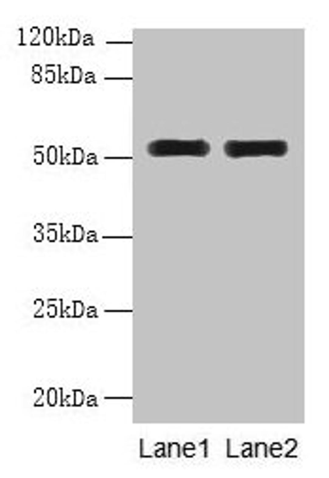 Western blot. All lanes: WDR88 antibody at 6µg/ml. Lane 1: MCF-7 whole cell lysate. Lane 2: A549 whole cell lysate. Secondary. Goat polyclonal to rabbit IgG at 1/10000 dilution. Predicted band size: 53, 48 kDa. Observed band size: 53 kDa