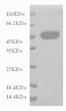 (Tris-Glycine gel) Discontinuous SDS-PAGE (reduced) with 5% enrichment gel and 15% separation gel.