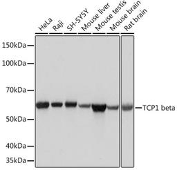 Western blot - TCP1 beta Rabbit mAb (A4700)