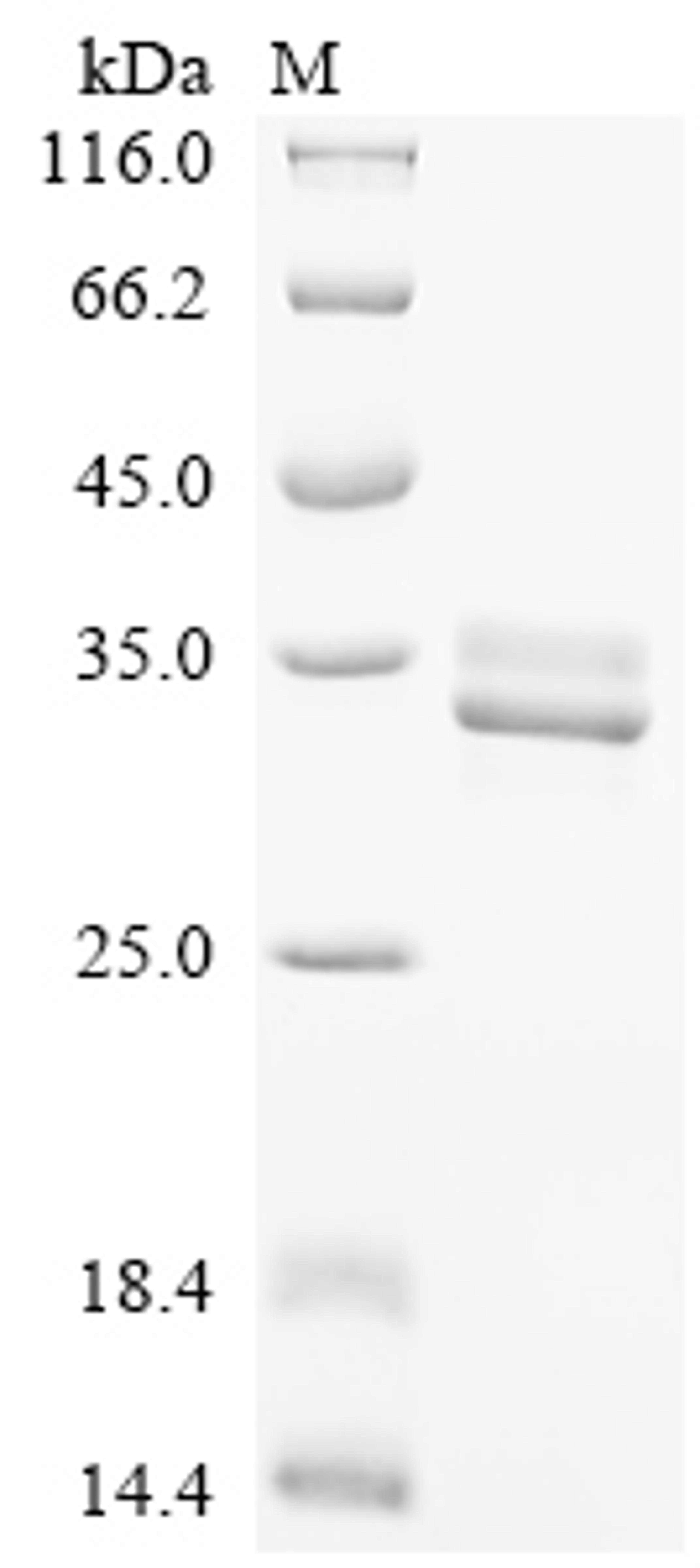 (Tris-Glycine gel) Discontinuous SDS-PAGE (reduced) with 5% enrichment gel and 15% separation gel.