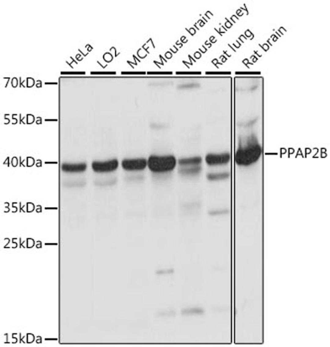 Western blot - PPAP2B antibody (A15743)