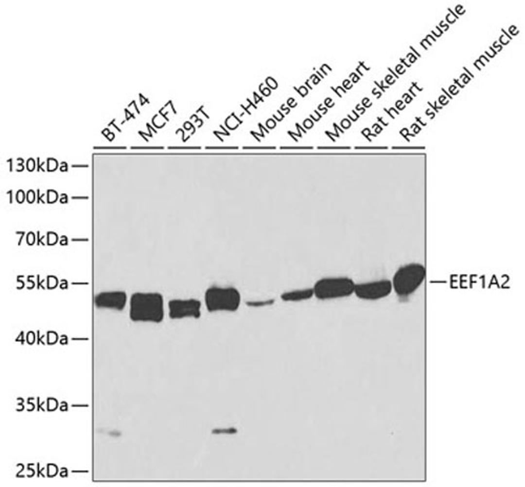 Western blot - EEF1A2 antibody (A2473)