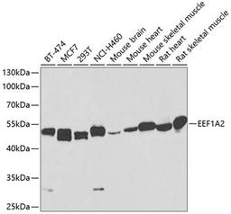 Western blot - EEF1A2 antibody (A2473)