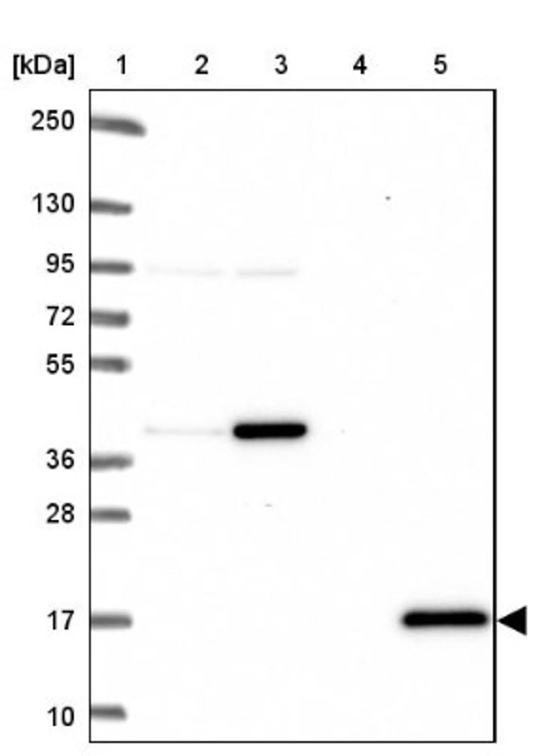 Western Blot: Citidine Deaminase Antibody [NBP2-39019] - Lane 1: Marker [kDa] 250, 130, 95, 72, 55, 36, 28, 17, 10<br/>Lane 2: RT-4<br/>Lane 3: U-251 MG<br/>Lane 4: Human Plasma<br/>Lane 5: Liver