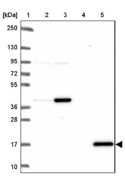 Western Blot: Citidine Deaminase Antibody [NBP2-39019] - Lane 1: Marker [kDa] 250, 130, 95, 72, 55, 36, 28, 17, 10<br/>Lane 2: RT-4<br/>Lane 3: U-251 MG<br/>Lane 4: Human Plasma<br/>Lane 5: Liver