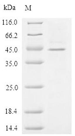 (Tris-Glycine gel) Discontinuous SDS-PAGE (reduced) with 5% enrichment gel and 15% separation gel.