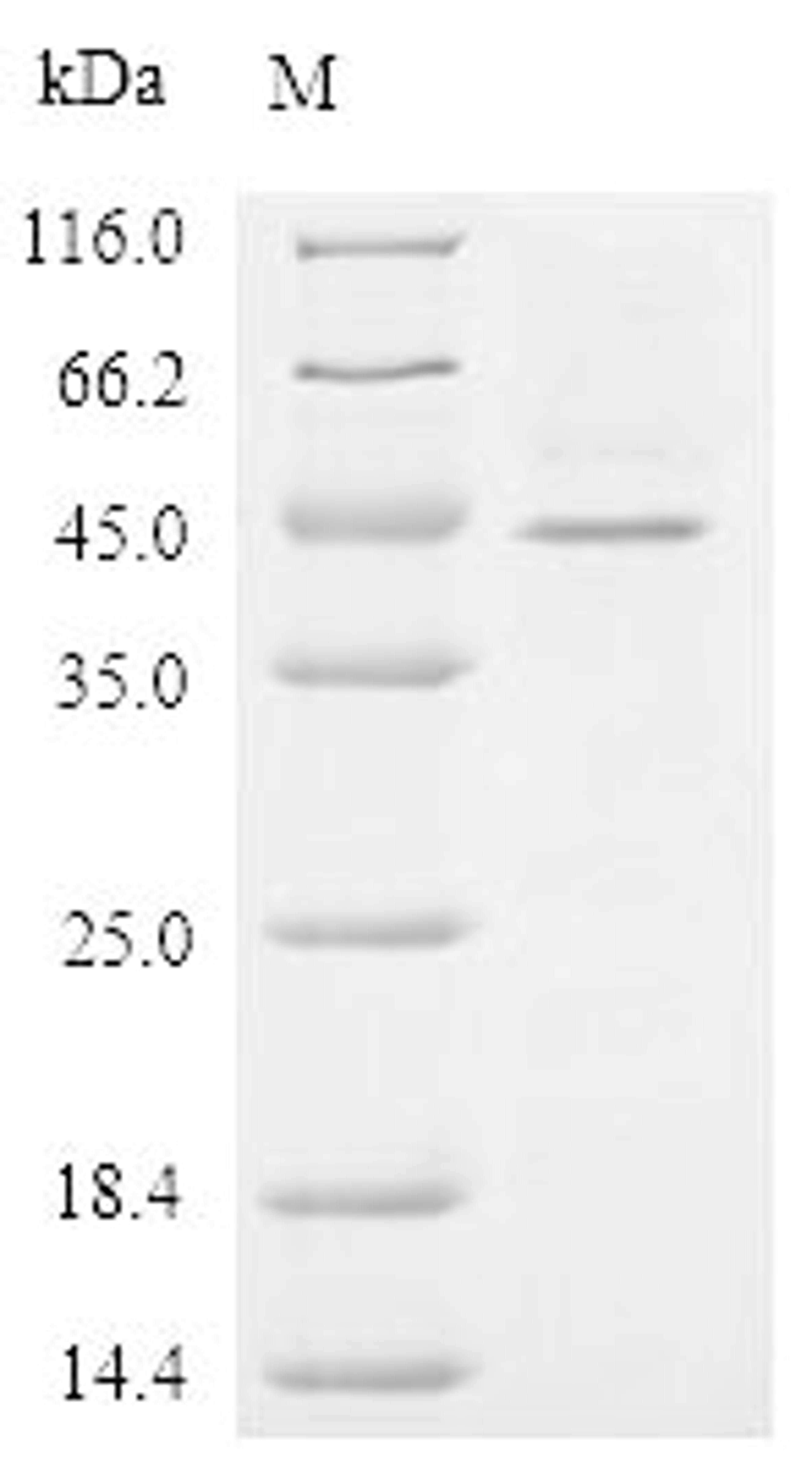 (Tris-Glycine gel) Discontinuous SDS-PAGE (reduced) with 5% enrichment gel and 15% separation gel.