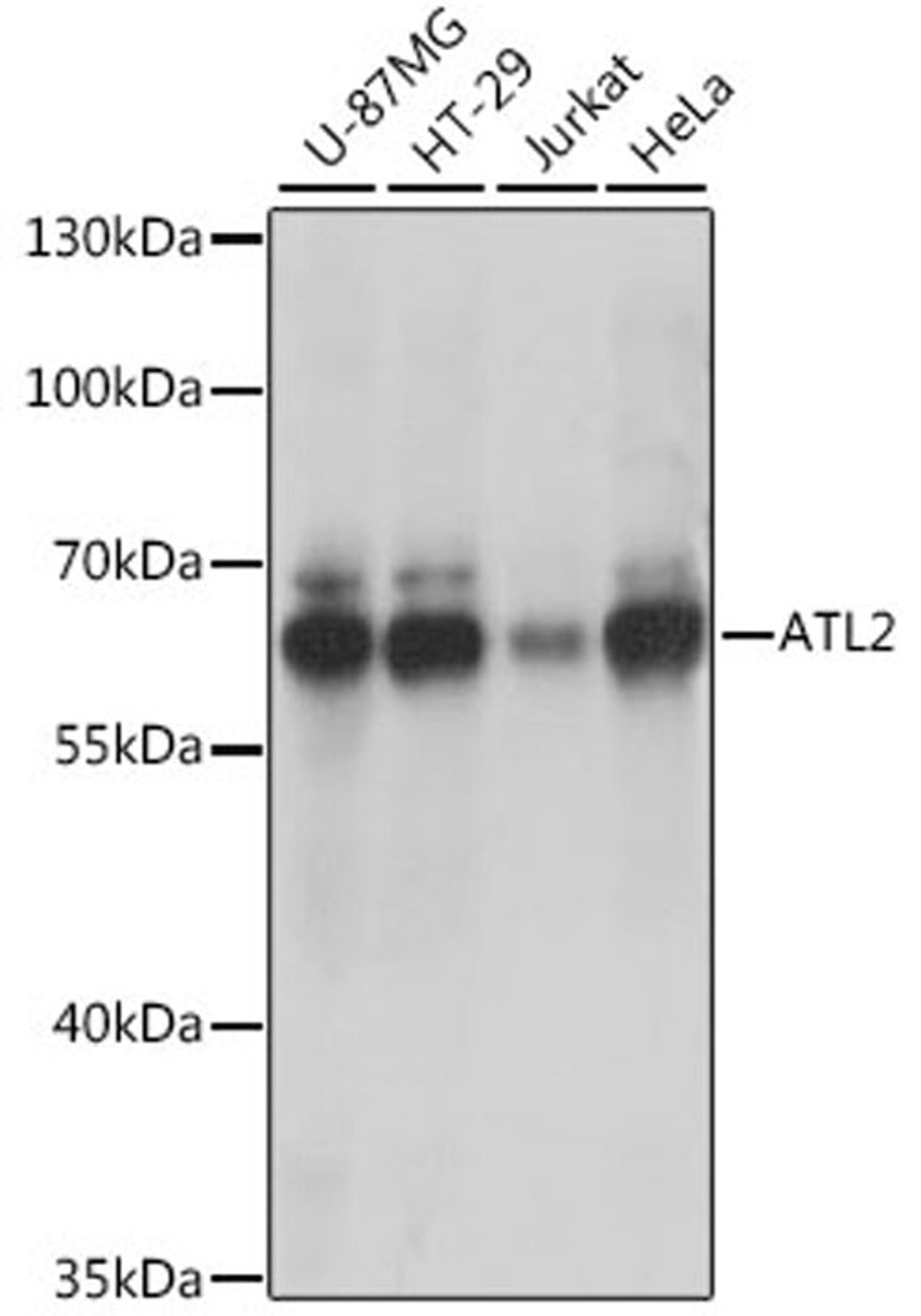 Western blot - ATL2 antibody (A15884)