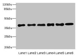 Western blot. All lanes: TMEM68 antibody at 4µg/ml. Lane 1: Mouse thymus tissue. Lane 2: K562 whole cell lysate. Lane 3: U251 whole cell lysate. Lane 4: HepG2 whole cell lysate. Lane 5: MCF-7 whole cell lysate. Lane 6: Jurkat whole cell lysate. Secondary. Goat polyclonal to rabbit IgG at 1/10000 dilution. Predicted band size: 38, 30, 16 kDa. Observed band size: 38 kDa