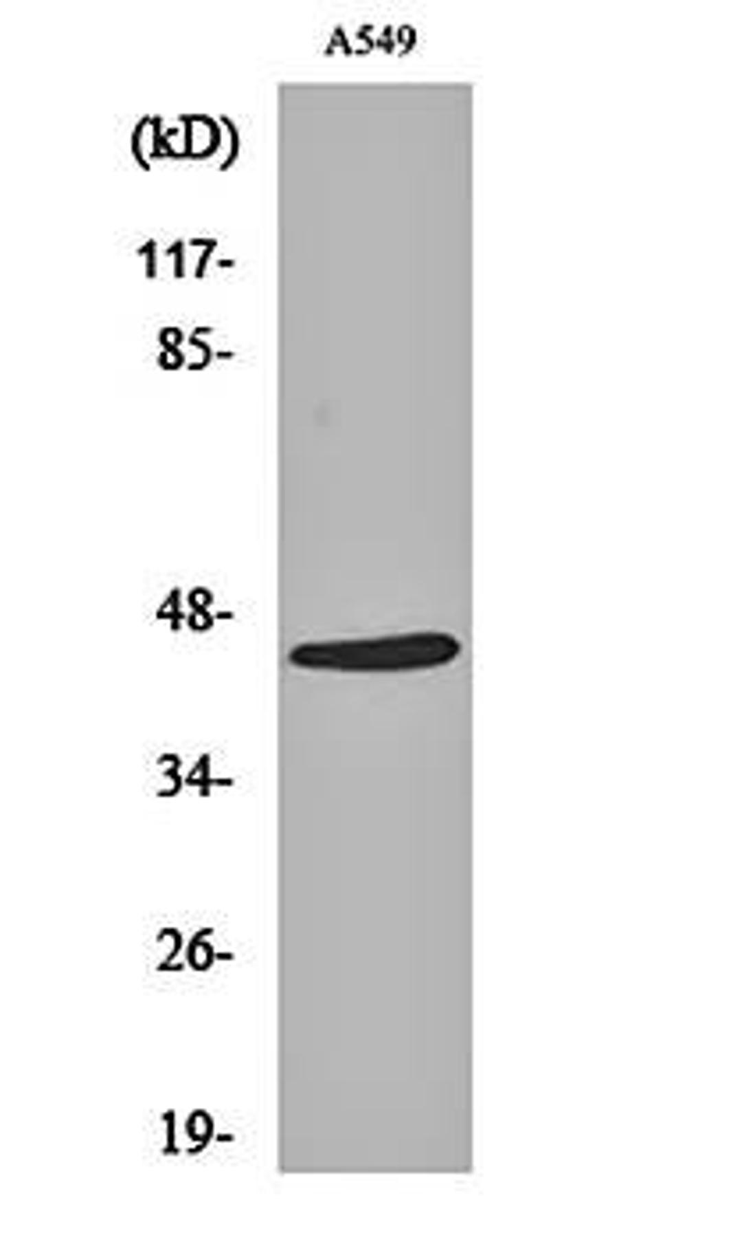 Western blot analysis of A549 cell lysates using Cleaved-MASP-1 HC (R448) antibody