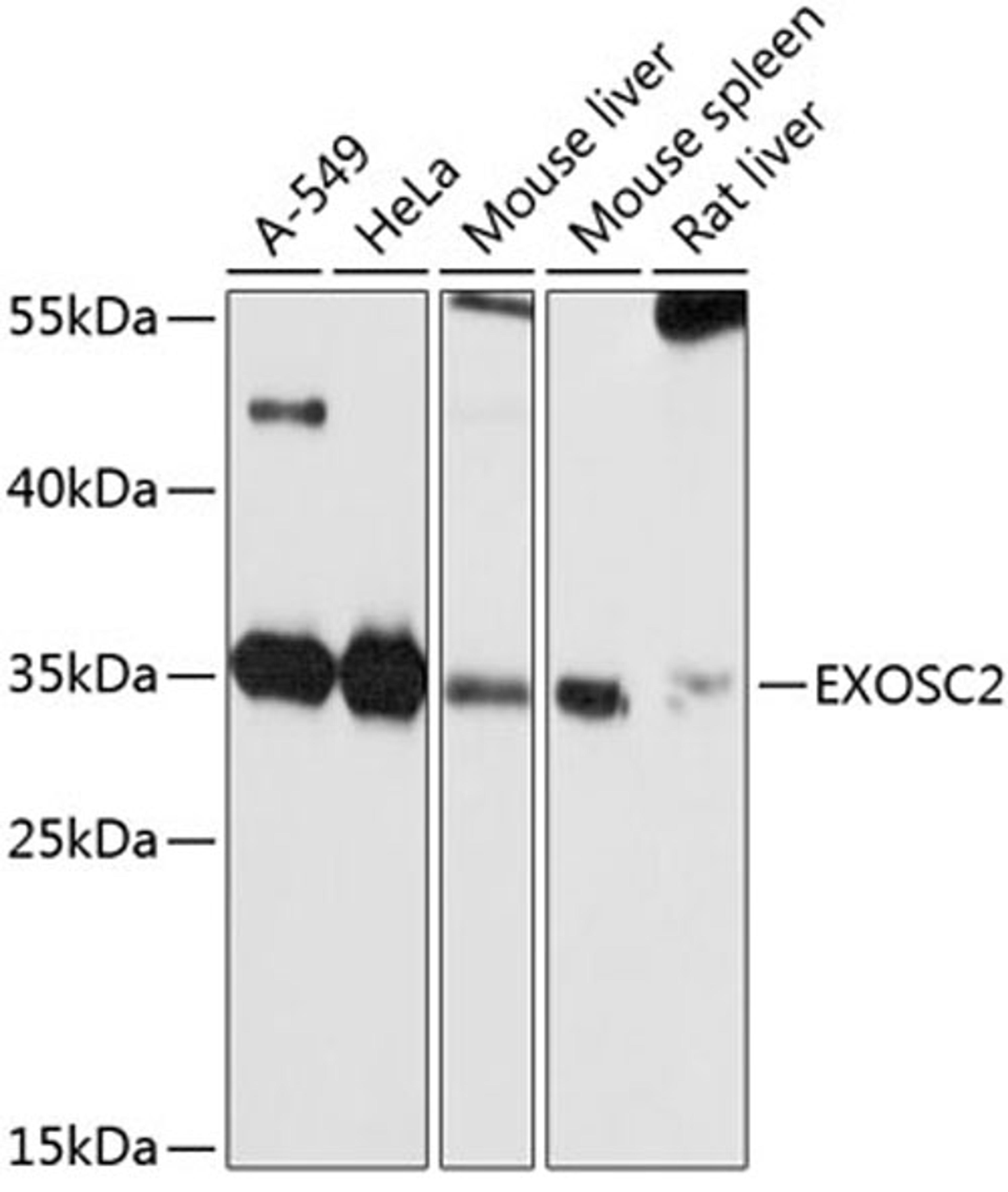 Western blot - EXOSC2 antibody (A10450)