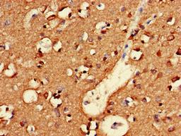 Immunohistochemistry of paraffin-embedded human brain tissue using CSB-PA839786LA01HU at dilution of 1:100