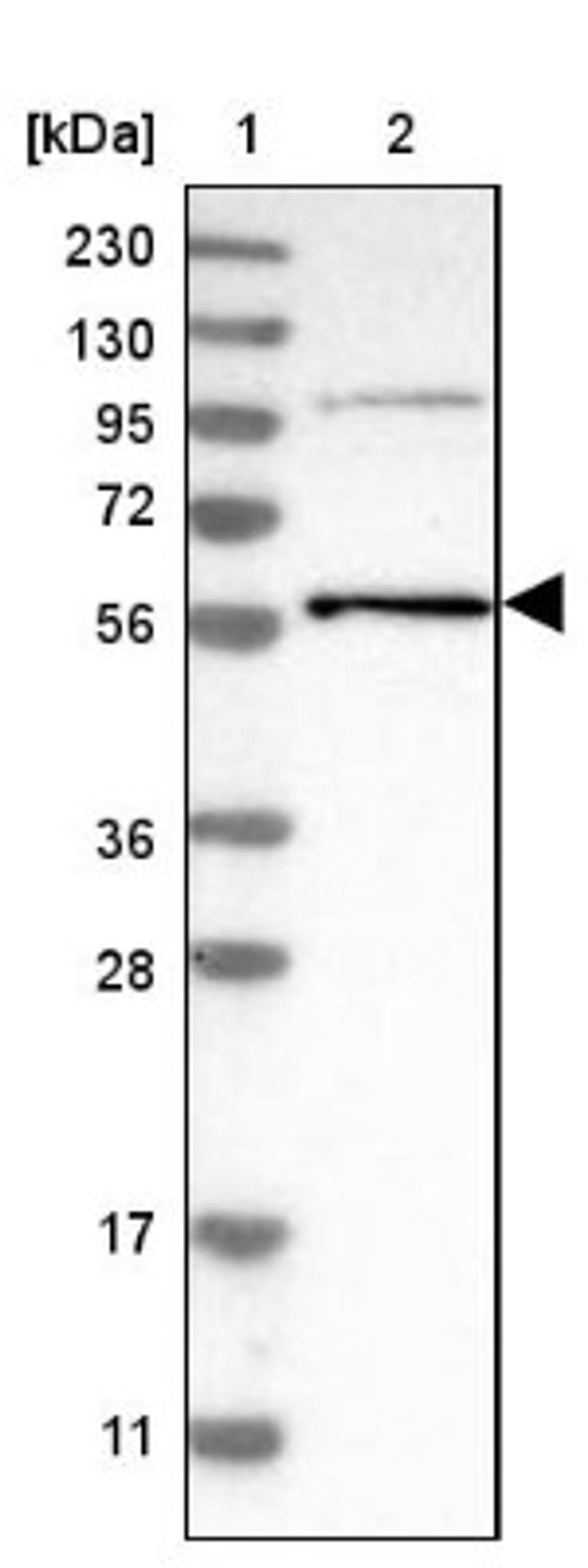 Western Blot: TRIM65 Antibody [NBP1-86017] - Lane 1: Marker [kDa] 230, 130, 95, 72, 56, 36, 28, 17, 11<br/>Lane 2: Human cell line RT-4