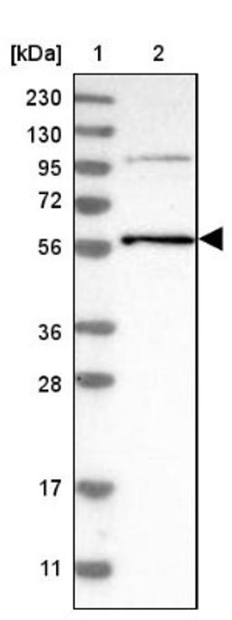 Western Blot: TRIM65 Antibody [NBP1-86017] - Lane 1: Marker [kDa] 230, 130, 95, 72, 56, 36, 28, 17, 11<br/>Lane 2: Human cell line RT-4