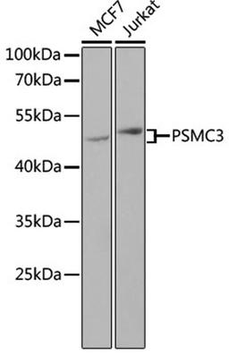 Western blot - PSMC3 antibody (A13345)