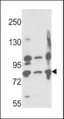 Western blot analysis of Neprilysin Antibody in A2058,A375,Ramos cell line lysates (35ug/lane)