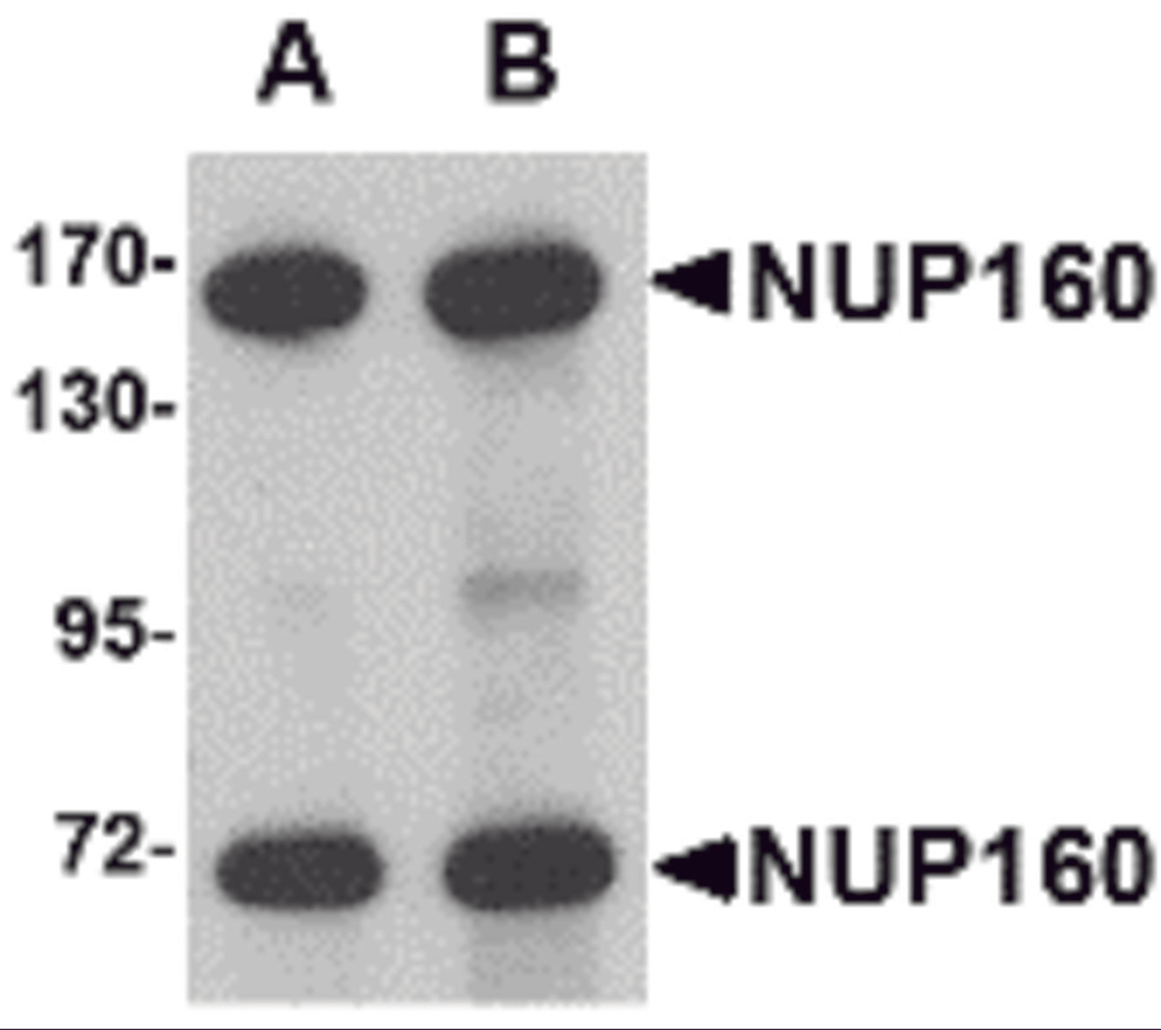 Western blot analysis of NUP160 in rat brain tissue lysate with NUP160 antibody at (A) 0.5 and (B) 1 &#956;g/mL.