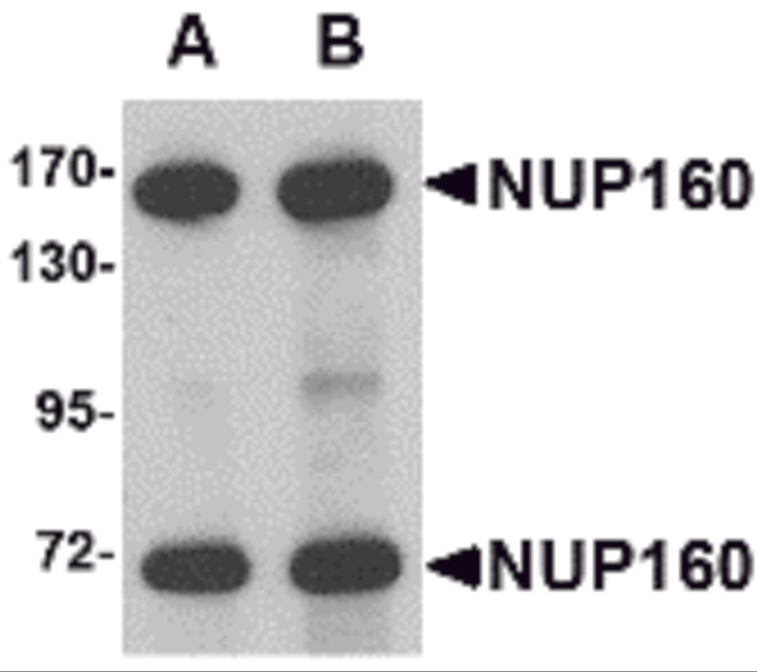 Western blot analysis of NUP160 in rat brain tissue lysate with NUP160 antibody at (A) 0.5 and (B) 1 μg/mL.
